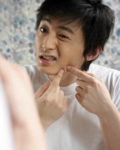Nam giới nên chọn kem trị mụn loại nào?
