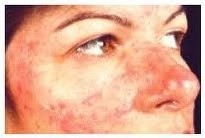 Làm gì khi nam giới bị dị ứng mỹ phẩm?